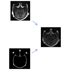 obraz medyczny MRI oraz jego segmentacji